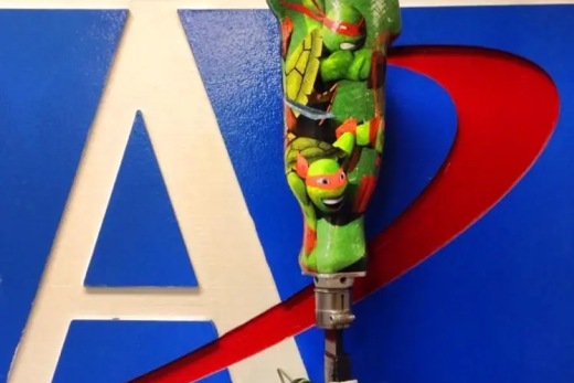 Advanced Prosthetics