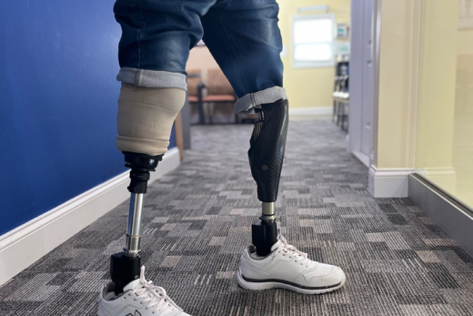 Lower-limb-prosthetic