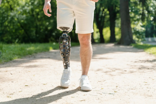 Advanced Prosthetics