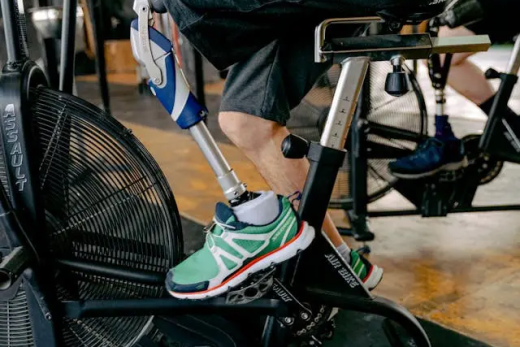 Advanced Prosthetics