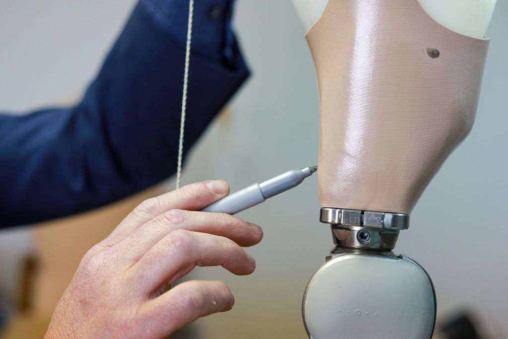 Advanced Prosthetics Custom Fabrication