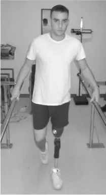 Definitive Prosthesis